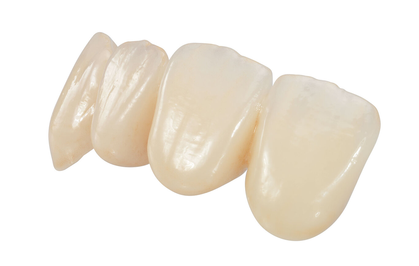 20 Years of IPS e.max: Leading All Ceramic Dental Material | Ivoclar LI