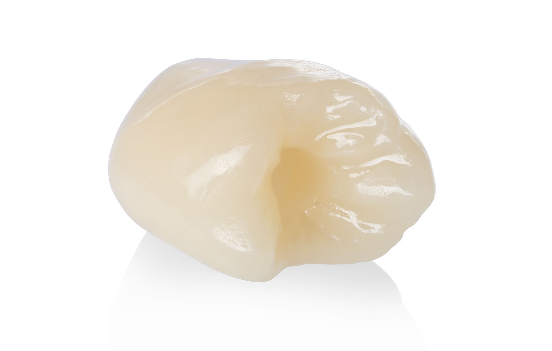 20 Years of IPS e.max: Leading All Ceramic Dental Material | Ivoclar