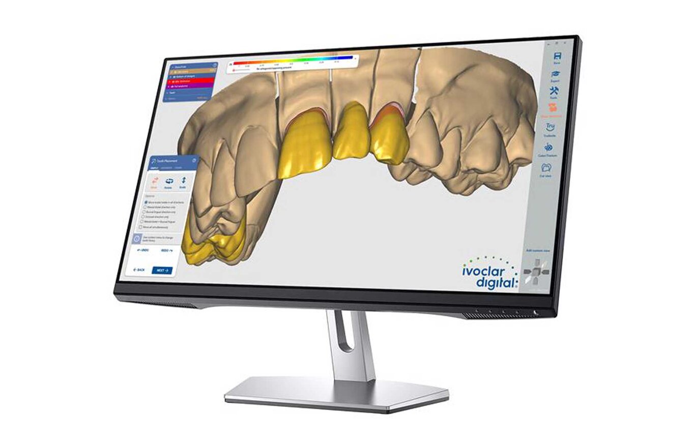 PrograMill CAM software | CAD/CAM for Dentistry | Ivoclar LI