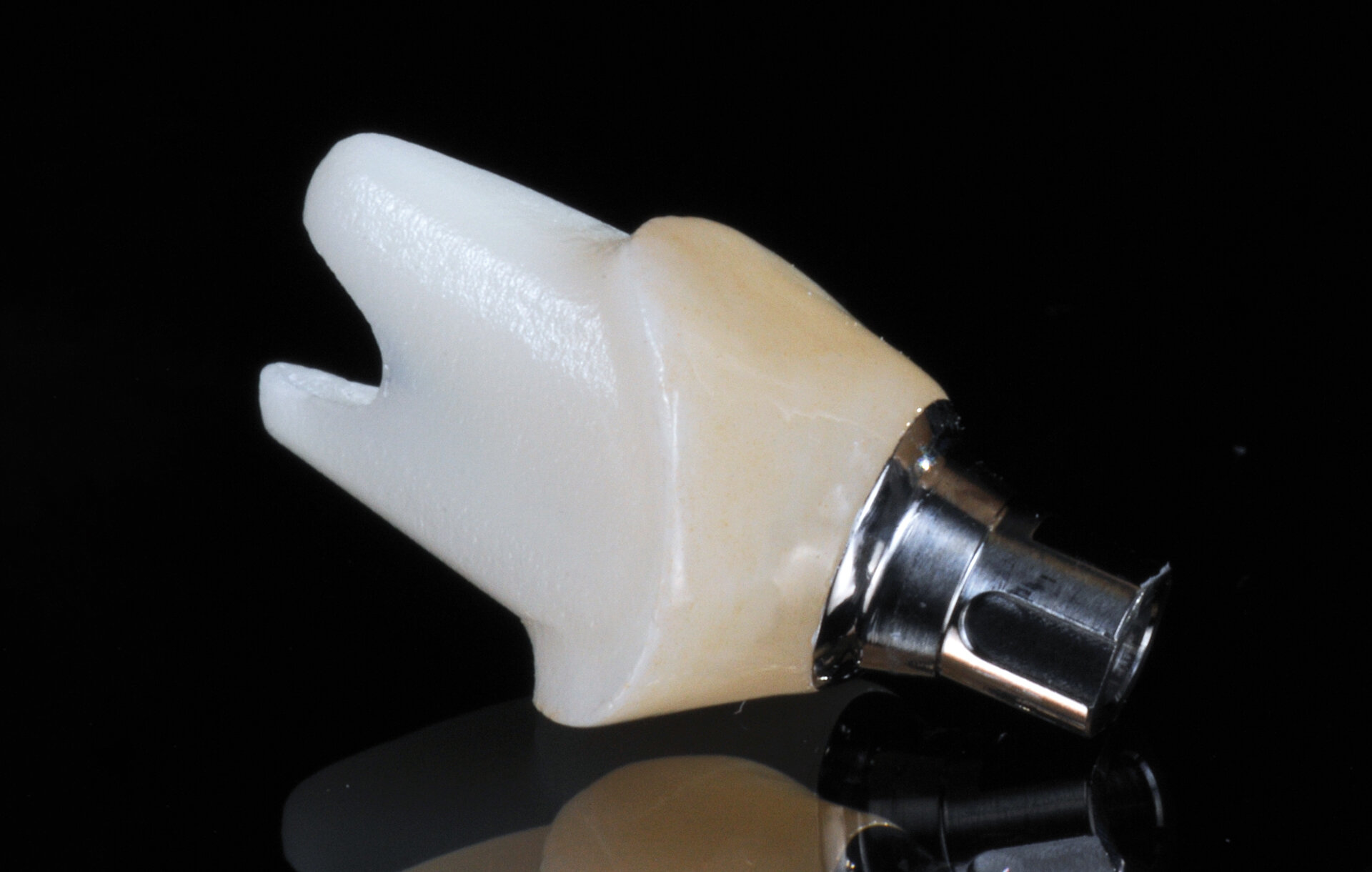 IPS e.max Press | Glass-ceramic Dental Restorations | Ivoclar USA