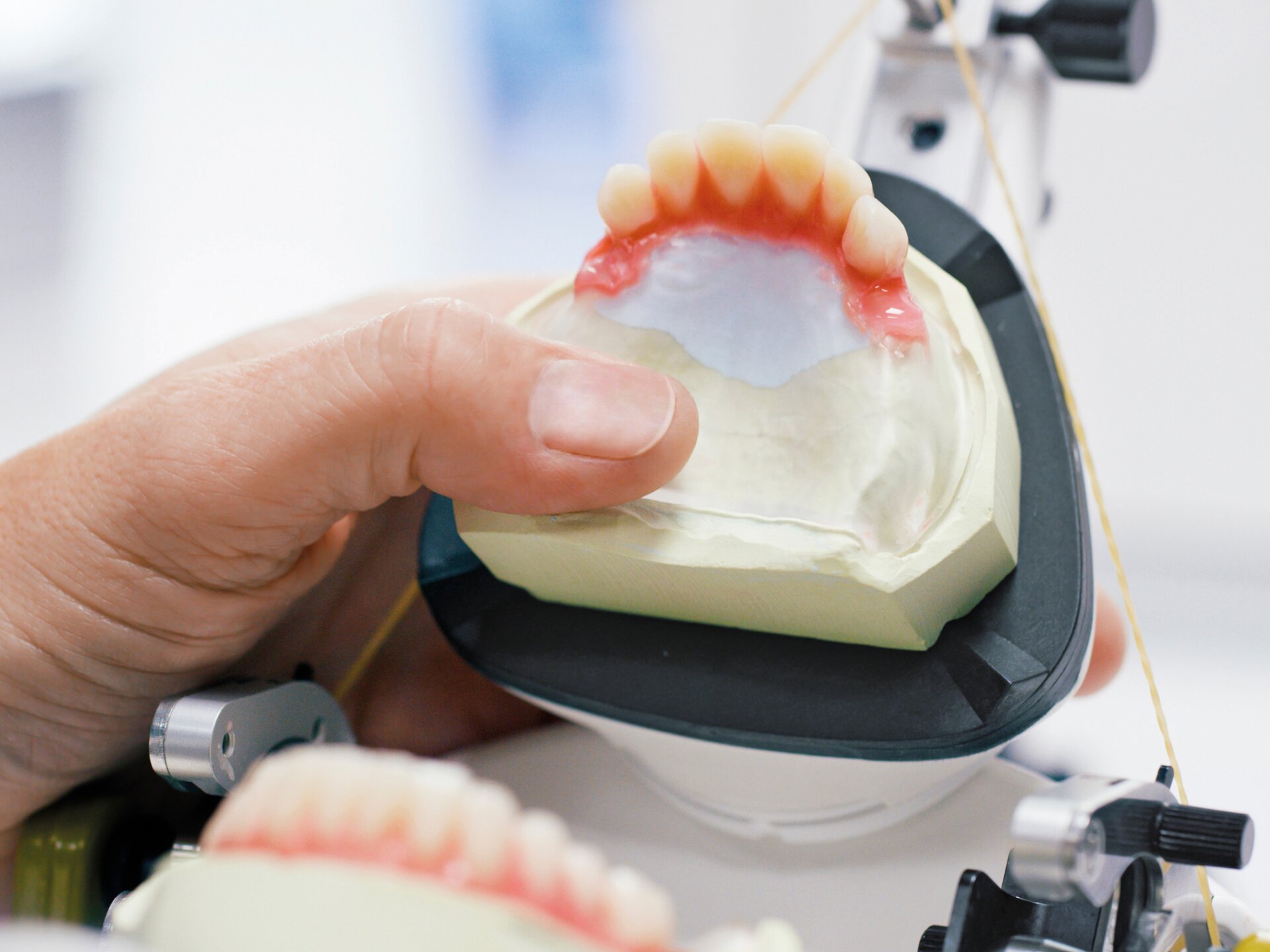 Removable Dental Prosthetics | Dental Workflows | Ivoclar USA