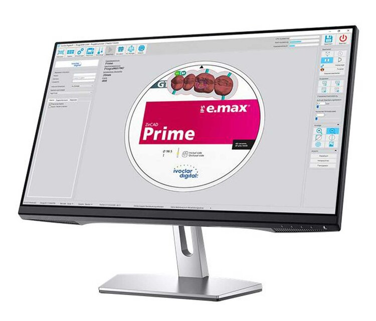 PrograPrint CAM | Dental 3D Printing Software | Ivoclar : Ivoclar