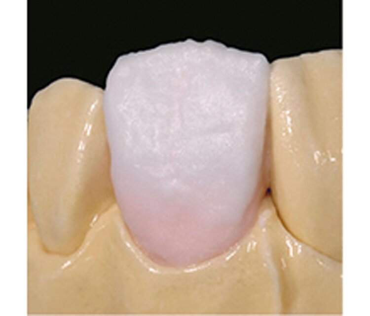 IPS e.max CAD | Lithium disilicate block for CAD/CAM | Ivoclar