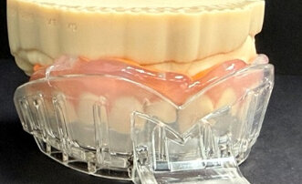 Injection Moulding: Rapid, Predictable Smile Transformation un a Single ...