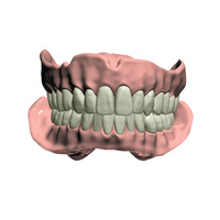 Full Dentures Stand-alone