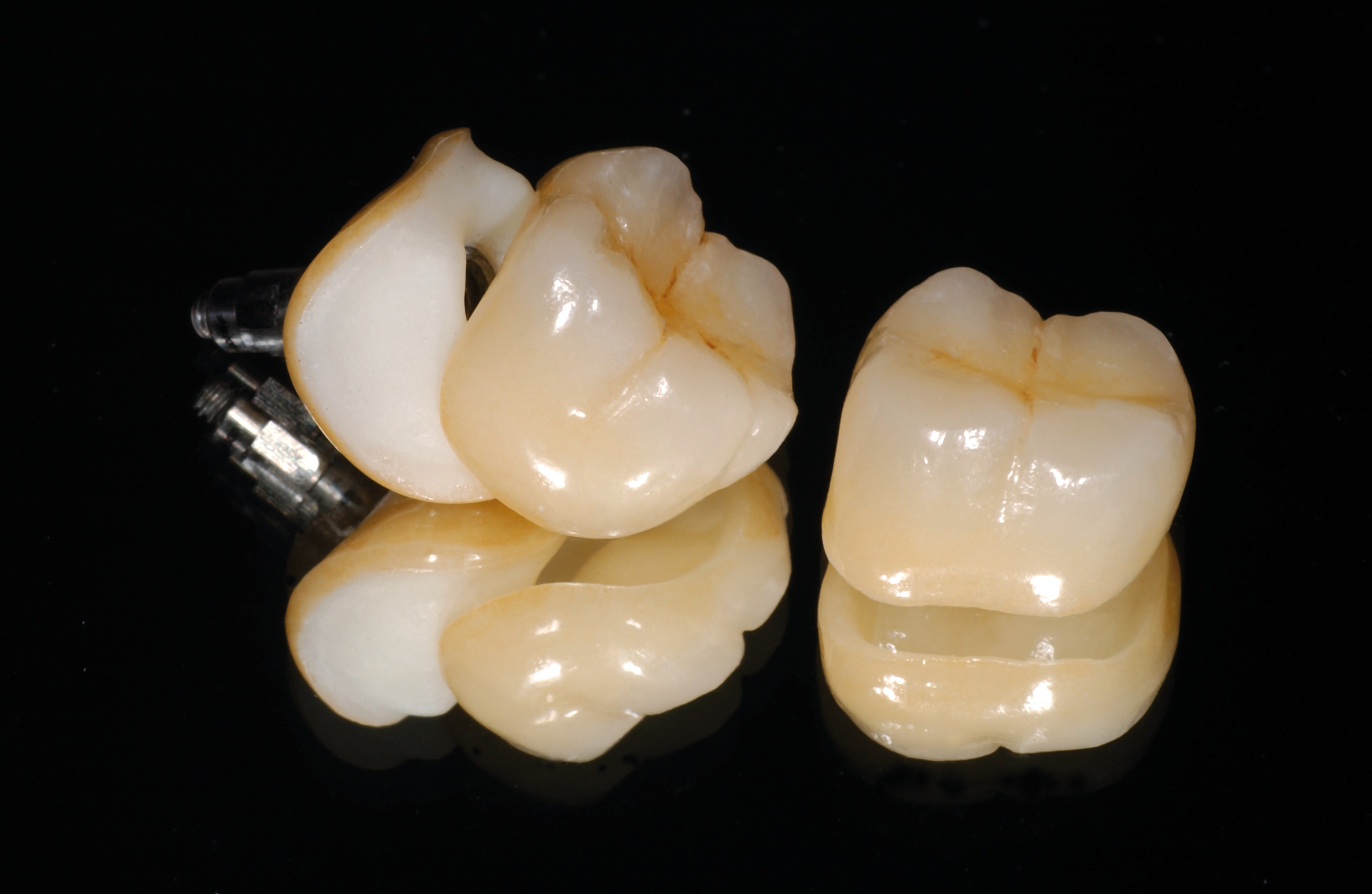 IPS e.max Press HT 5 Stk. | All Ceramics | Ivoclar US