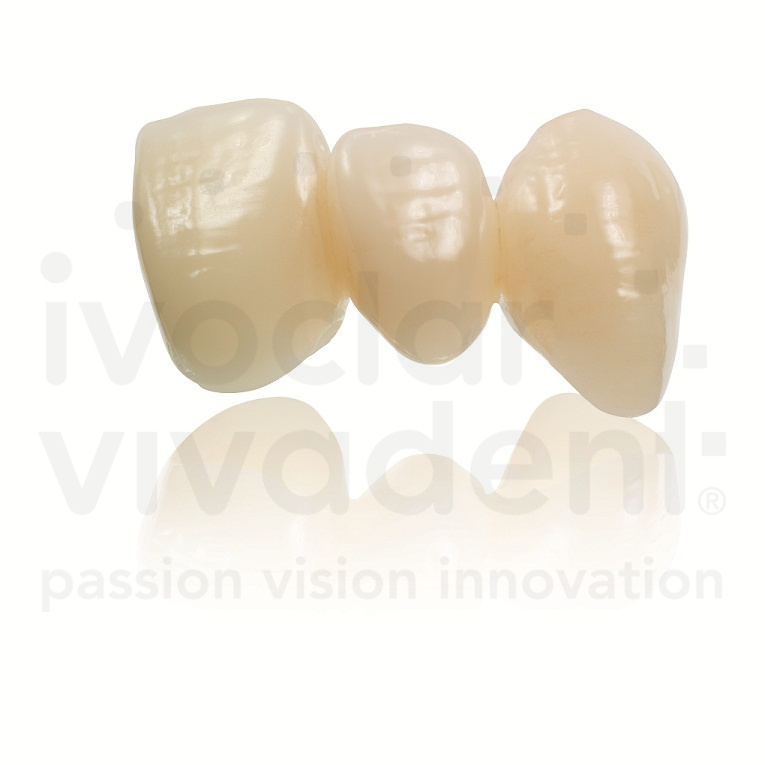 IPS e.max CAD Characterization Kit | CAD/CAM | Ivoclar Vivadent US